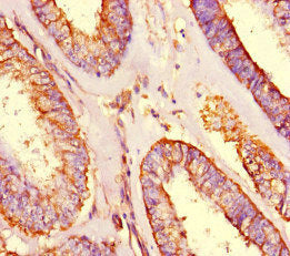 Immunofluorescent analysis of HepG2 cells using CAC12842 at dilution of 1:100 and Alexa Fluor 488-congugated AffiniPure Goat Anti-Rabbit IgG(H+L)
