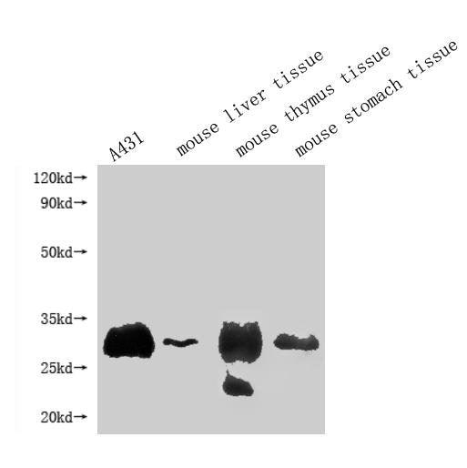 RTP4 Polyclonal Antibody - image 2