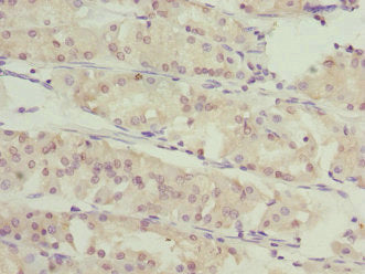 SLC46A1 Polyclonal Antibody - image 2