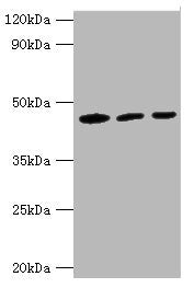 Immunohistochemistry of paraffin-embedded human testis tissue using CAC12905 at dilution of 1:100