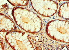 IDH1 Polyclonal Antibody - image 4