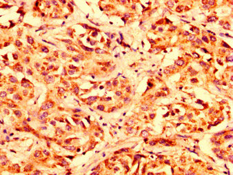Immunofluorescence staining of Hela cells with CAC12909 at 1:100, counter-stained with DAPI. The cells were fixed in 4% formaldehyde, permeabilized using 0.2% Triton X-100 and blocked in 10% normal Goat Serum. The cells were then incubated with the antibody overnight at 4°C. The secondary antibody was Alexa Fluor 488-congugated AffiniPure Goat Anti-Rabbit IgG(H+L).