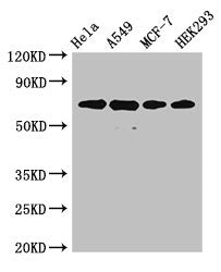Immunohistochemistry of paraffin-embedded human prostate cancer using CAC12912 at dilution of 1:100