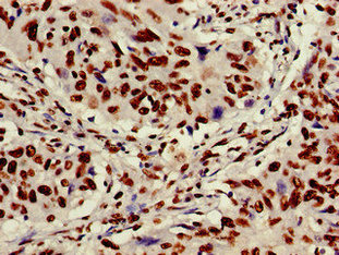 Immunofluorescent analysis of PC-3 cells using CAC12912 at dilution of 1:100 and Alexa Fluor 488-congugated AffiniPure Goat Anti-Rabbit IgG(H+L)