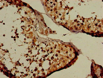 Immunohistochemistry of paraffin-embedded human pancreatic tissue using CAC12914 at dilution of 1:100