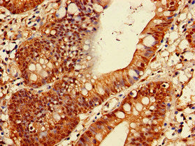 Immunofluorescent analysis of PC-3 cells using CAC12918 at dilution of 1:100 and Alexa Fluor 488-congugated AffiniPure Goat Anti-Rabbit IgG(H+L)
