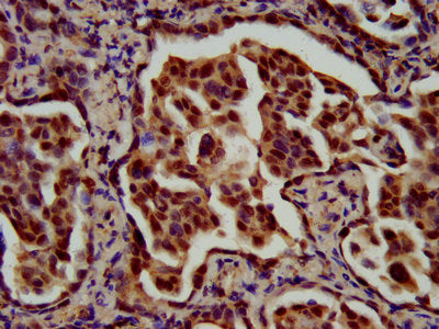 RFX1 Polyclonal Antibody - image 4