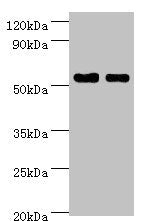 Immunohistochemistry of paraffin-embedded human colon tissue using CAC12924 at dilution of 1:100