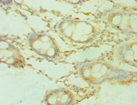 Immunohistochemistry of paraffin-embedded human placenta tissue using CAC12924 at dilution of 1:100