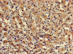 Western Blot, Positive WB detected in: Mouse kidney tissue, All lanes: ZBTB16 antibody at 2.5ug/ml, Secondary, Goat polyclonal to rabbit IgG at 1/50000 dilution, Predicted band size: 75, 62 kDa, Observed band size: 75 kDa