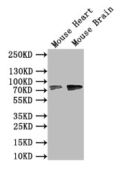 ZBTB16 Polyclonal Antibody - image 3