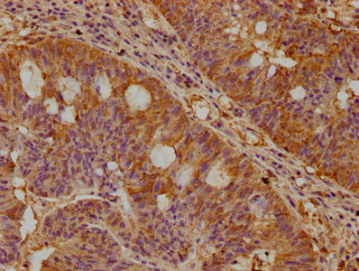 NEK10 Polyclonal Antibody - image 3