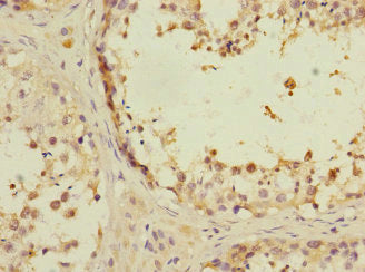 Immunohistochemistry of paraffin-embedded human brain tissue using CAC12941 at dilution of 1:100