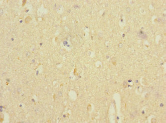 ANKS1B Polyclonal Antibody - image 4
