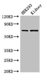 IHC image of CAC12955 diluted at 1:150 and staining in paraffin-embedded human lung tissue performed on a Leica BondTM system. After dewaxing and hydration, antigen retrieval was mediated by high pressure in a citrate buffer (pH 6.0). Section was blocked with 10% normal goat serum 30min at RT. Then primary antibody (1% BSA) was incubated at 4°C overnight. The primary is detected by a biotinylated secondary antibody and visualized using an HRP conjugated SP system.