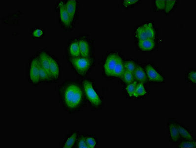 RABGGTA Polyclonal Antibody - image 5