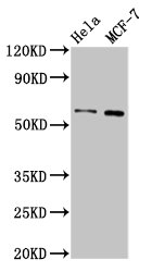 IHC image of CAC12961 diluted at 1:100 and staining in paraffin-embedded human lung tissue performed on a Leica BondTM system. After dewaxing and hydration, antigen retrieval was mediated by high pressure in a citrate buffer (pH 6.0). Section was blocked with 10% normal goat serum 30min at RT. Then primary antibody (1% BSA) was incubated at 4°C overnight. The primary is detected by a biotinylated secondary antibody and visualized using an HRP conjugated SP system.