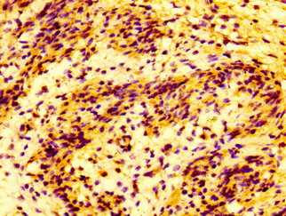 IHC image of CAC12961 diluted at 1:100 and staining in paraffin-embedded human testis tissue performed on a Leica BondTM system. After dewaxing and hydration, antigen retrieval was mediated by high pressure in a citrate buffer (pH 6.0). Section was blocked with 10% normal goat serum 30min at RT. Then primary antibody (1% BSA) was incubated at 4°C overnight. The primary is detected by a biotinylated secondary antibody and visualized using an HRP conjugated SP system.