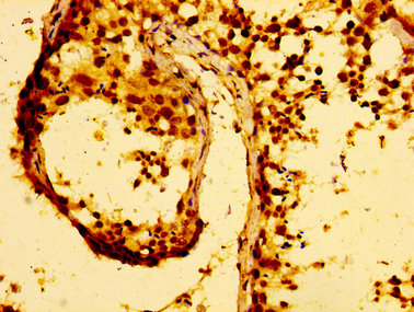 Immunofluorescence staining of A549 cells with CAC12961 at 1:100, counter-stained with DAPI. The cells were fixed in 4% formaldehyde, permeabilized using 0.2% Triton X-100 and blocked in 10% normal Goat Serum. The cells were then incubated with the antibody overnight at 4°C. The secondary antibody was Alexa Fluor 488-congugated AffiniPure Goat Anti-Rabbit IgG(H+L).