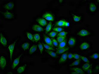MMP28 Polyclonal Antibody - image 5