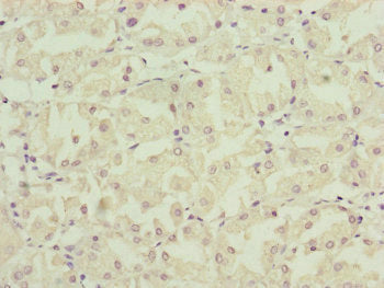 Immunofluorescent analysis of HepG2 cells using CAC12963 at dilution of 1:100 and Alexa Fluor 488-congugated AffiniPure Goat Anti-Rabbit IgG(H+L)
