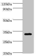 Immunohistochemistry of paraffin-embedded human placenta tissue using CAC12969 at dilution of 1:100
