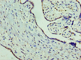 SLC25A15 Polyclonal Antibody - image 3