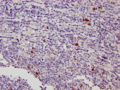 IHC image of CAC12972 diluted at 1:500 and staining in paraffin-embedded human appendix tissue performed on a Leica BondTM system. After dewaxing and hydration, antigen retrieval was mediated by high pressure in a citrate buffer (pH 6.0). Section was blocked with 10% normal goat serum 30min at 37℃ Then primary antibody (1% BSA) was incubated at 4°C overnight. The primary is detected by a Goat anti-Mouse IgG labeled by HRP and visualized using 0.05% DAB.