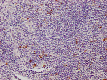 Overlay Peak curve showing A549 cells stained with CAC12972 (red line) at 1:100. The cells were incubated in 10% normal goat serum to block non-specific protein-protein interactions followed by the antibody (1ug/1*10 6  cells) for 1h at 4°C. The secondary antibody used was FITC-conjugated Goat Anti-Mouse IgG(H+L) at 1/100 dilution for 30min at 4°C. Isotype control antibody (green line) was mouse IgG1 (1ug/1*10 6  cells) used under the same conditions. Acquisition of >10,000 events was performed.