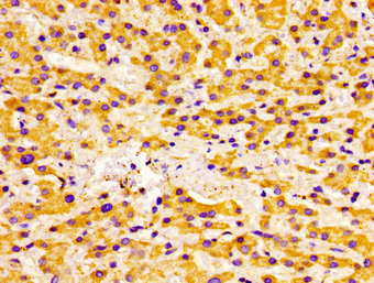 Immunofluorescent analysis of A549 cells using CAC12983 at dilution of 1:100 and Alexa Fluor 488-congugated AffiniPure Goat Anti-Rabbit IgG(H+L)