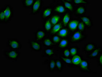 ACADVL Polyclonal Antibody - image 5