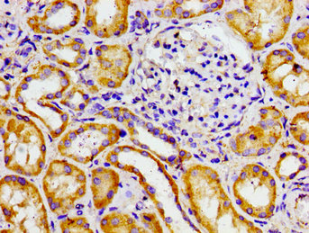 Immunohistochemistry of paraffin-embedded human heart tissue using CAC12985 at dilution of 1:100