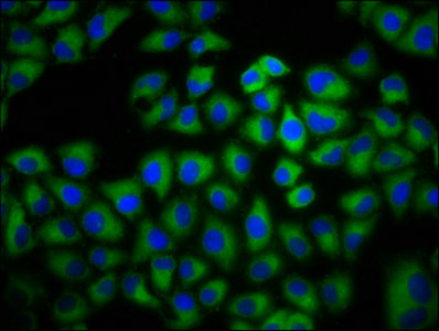 ADCY6 Polyclonal Antibody - image 4