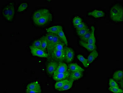 AMD1 Polyclonal Antibody - image 3