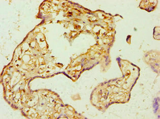 AMPD3 Polyclonal Antibody - image 3
