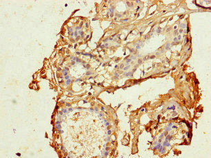 Immunofluorescent analysis of Hela cells using CAC13007 at dilution of 1:100 and Alexa Fluor 488-congugated AffiniPure Goat Anti-Rabbit IgG(H+L)