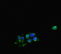 CDK7 Polyclonal Antibody - image 3