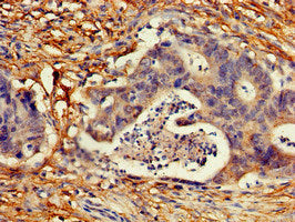 Immunofluorescent analysis of Hela cells using CAC13008 at dilution of 1:100 and Alexa Fluor 488-congugated AffiniPure Goat Anti-Rabbit IgG(H+L)