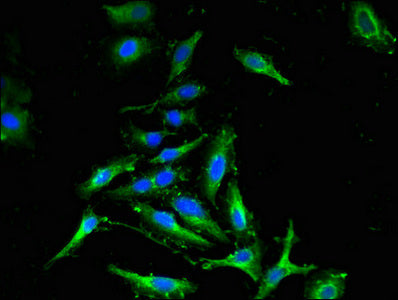 CDKN2C Polyclonal Antibody - image 3