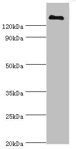 Immunohistochemistry of paraffin-embedded human small intestine tissue using CAC13012 at dilution of 1:100