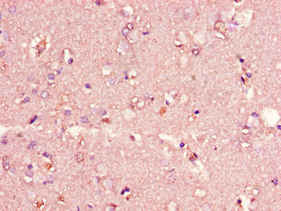 Immunohistochemistry of paraffin-embedded human liver tissue using CAC13014 at dilution of 1:100