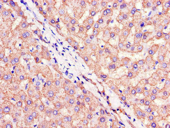 Immunofluorescent analysis of Hela cells using CAC13014 at dilution of 1:100 and Alexa Fluor 488-congugated AffiniPure Goat Anti-Rabbit IgG(H+L)