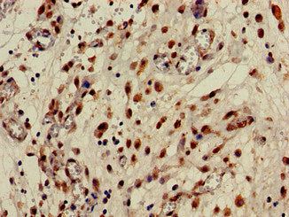 Immunofluorescent analysis of PC-3 cells using CAC13015 at dilution of 1:100 and Alexa Fluor 488-congugated AffiniPure Goat Anti-Rabbit IgG(H+L)