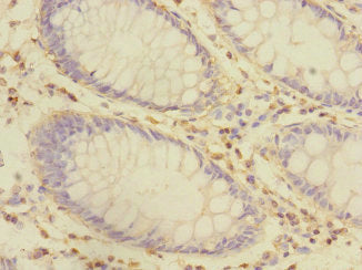 Immunohistochemistry of paraffin-embedded human kidney tissue using CAC13016 at dilution of 1:100