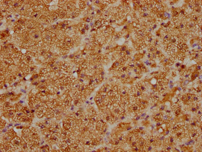 Immunofluorescence staining of HepG2 with CAC13022 at 1:33, counter-stained with DAPI. The cells were fixed in 4% formaldehyde, permeabilized using 0.2% Triton X-100 and blocked in 10% normal Goat Serum. The cells were then incubated with the antibody overnight at 4°C. The secondary antibody was Alexa Fluor 488-congugated AffiniPure Goat Anti-Rabbit IgG(H+L).