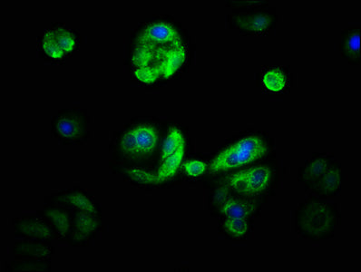 CYP21A2 Polyclonal Antibody - image 4