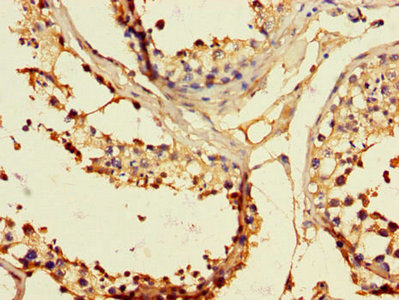 Immunofluorescent analysis of Hela cells using CAC13029 at dilution of 1:100 and Alexa Fluor 488-congugated AffiniPure Goat Anti-Rabbit IgG(H+L)