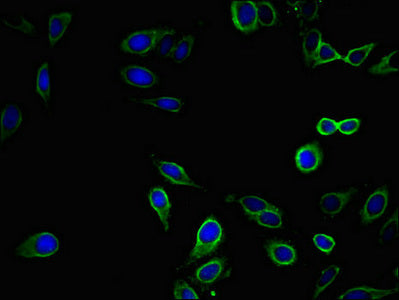 EPHB2 Polyclonal Antibody - image 3