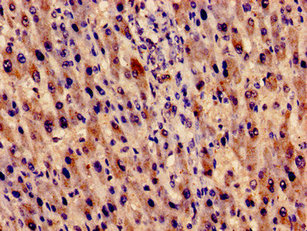 EVC Polyclonal Antibody - image 4