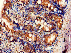 Immunofluorescent analysis of A549 cells using CAC13034 at dilution of 1:100 and Alexa Fluor 488-congugated AffiniPure Goat Anti-Rabbit IgG(H+L)
